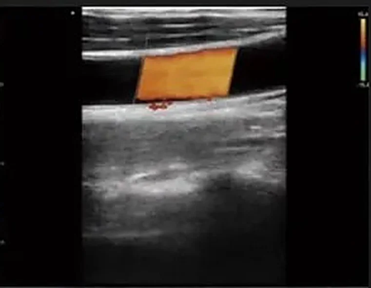 Estruturas superficiais em alta definição no app RC Medical