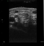 RC DERMATOLOGY - Diagnóstico de Alta Precisão para a Medicina Estética e Dermatológica