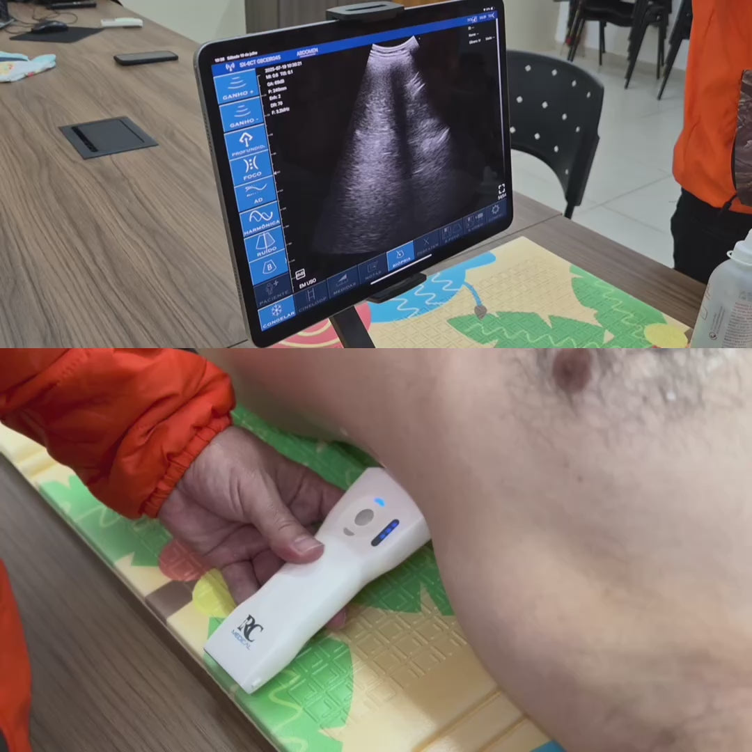 RC Scanner PRO Ultrassom Portátil Premium